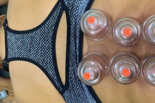 Imagem 2 da galeria do parceiro Studio de Pilates Terapêutico Gabriella Dornelas