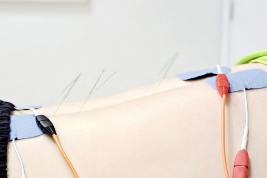 Imagem 3 da galeria do parceiro Fisioterapia Alvarenga