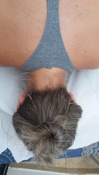 Imagem 2 da galeria do parceiro Fabiana Yamamoto RPG, Pilates e Estetica