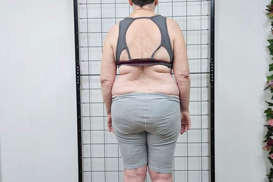 Imagem 3 da galeria do parceiro Ativa Idade REABILITAÇÃO DO MOVIMENTO